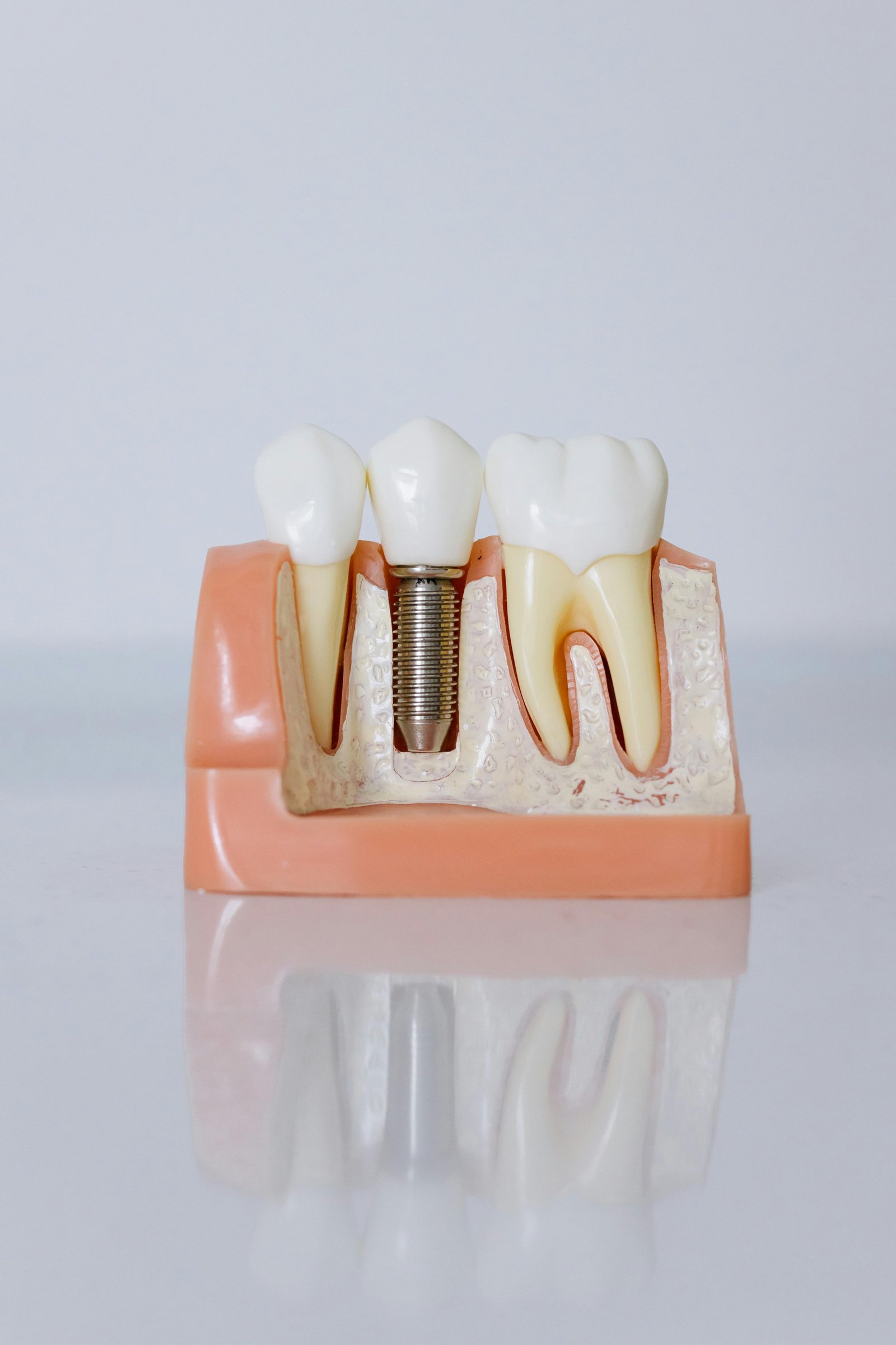 Dental implant tools and treatment setup